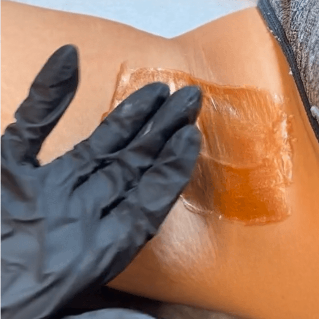 Brazilian and Underarm 6 Month