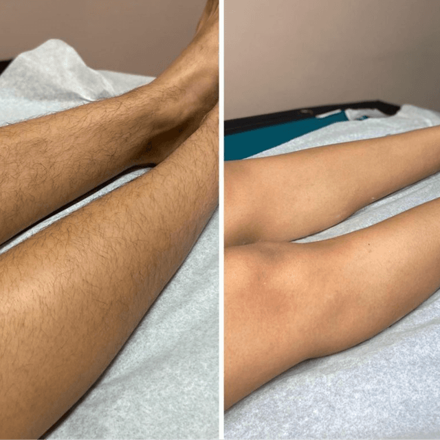 Full Leg + Full Face 6 Services at The Beauty Nook in Virginia Beach, VA
